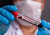 Identifican al ‘paciente cero’ de hantavirus y sus posibles causas de contagio